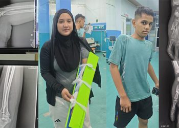 Dua Atlet Taekwondo Aceh Timur Cedera di Prapora Sigli