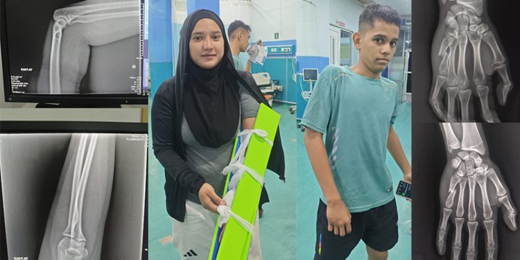 Dua Atlet Taekwondo Aceh Timur Cedera di Prapora Sigli